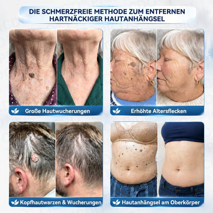 👩‍⚕️🎁𝐏𝐢𝐜𝐝𝐨® 𝟕-𝐓𝐚𝐠𝐞 𝐂𝐫𝐞𝐦𝐞 𝐆𝐞𝐠𝐞𝐧 𝐇𝐚𝐮𝐭𝐚𝐧𝐡ä𝐧𝐠𝐬𝐞𝐥- & 𝐏𝐢𝐠𝐦𝐞𝐧𝐭𝐟𝐥𝐞𝐜𝐤𝐞𝐧 (𝐒𝐜𝐡𝐦𝐞𝐫𝐳𝐟𝐫𝐞𝐢𝐞 𝐅𝐨𝐫𝐦𝐞𝐥 – 𝐨𝐡𝐧𝐞 𝐍𝐚𝐫𝐛𝐞𝐧)