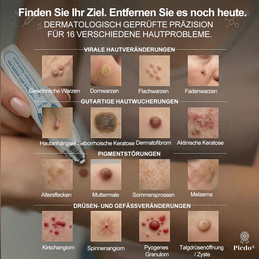 Offizieller Shop | 🎉🎁 𝐏i𝐜𝐝o® 7-Tage-Serum zur Entfernung von Hautanhängseln & Flecken (schmerzfrei, narbenfrei, Roll-On) 🔥